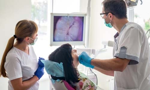 Intraoral HD Camera