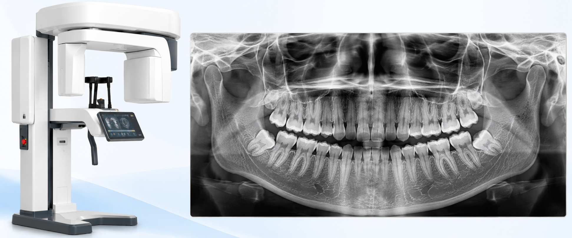 Kodak CS 8100 OPG – Full Mouth X-Ray