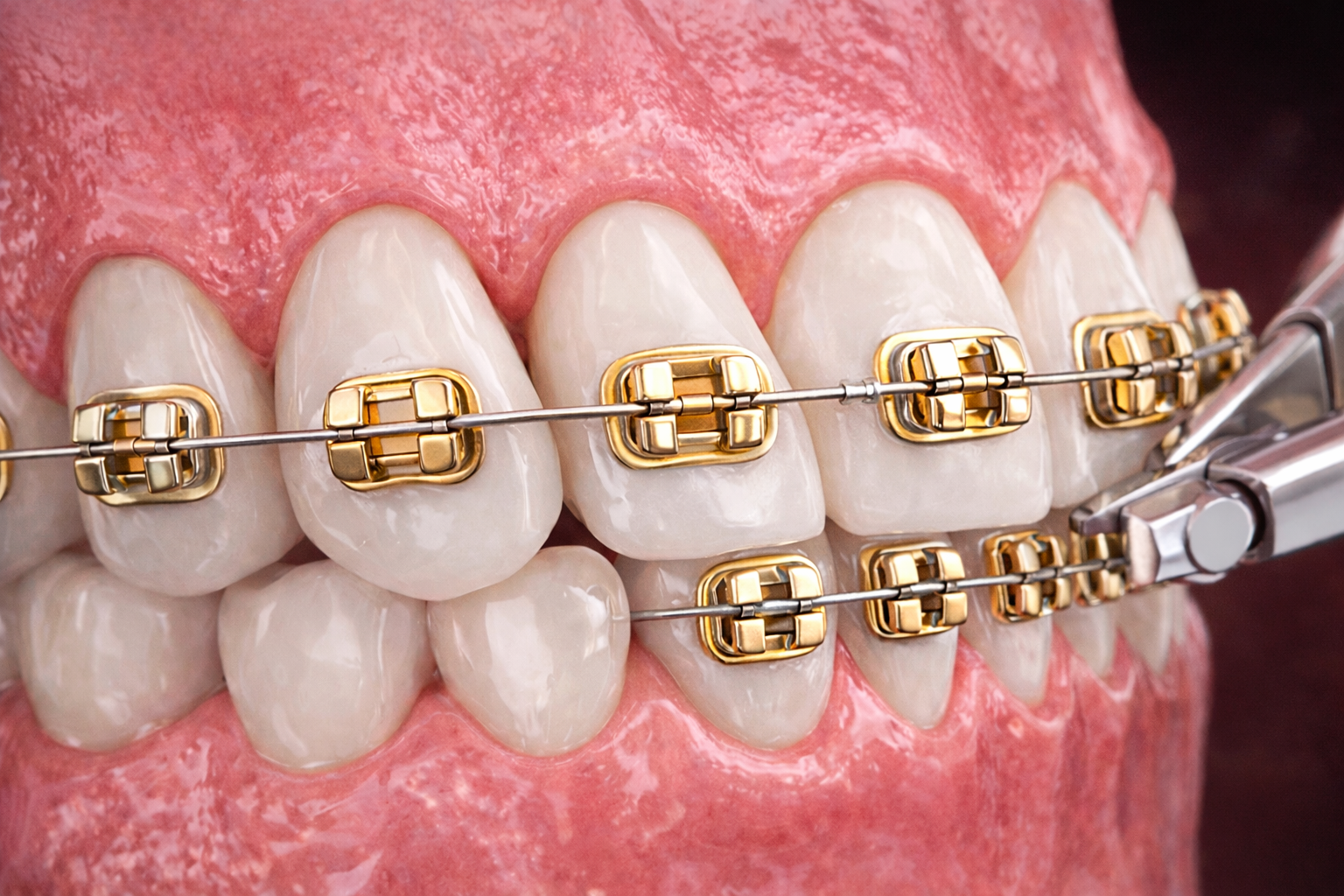 Digital smile planning and cosmetic dental care